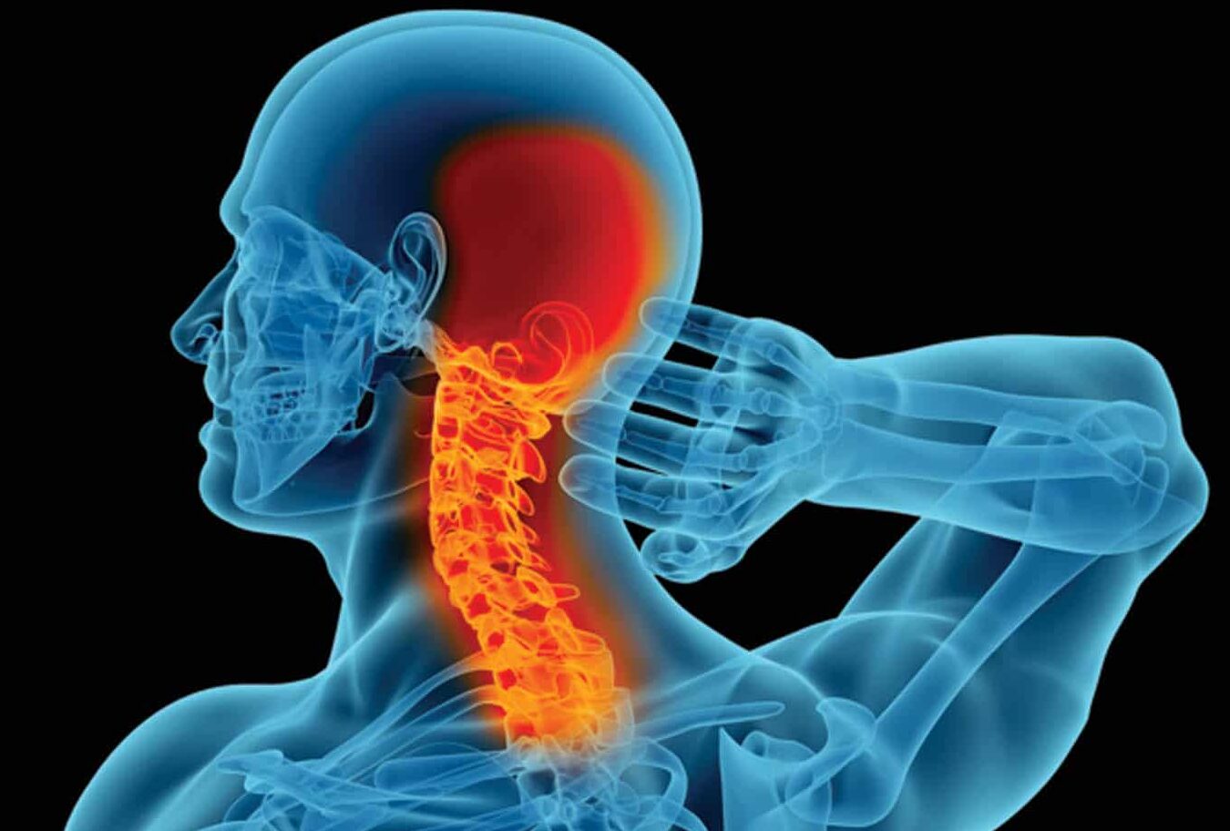 Anatomical illustration of the cervical spine and neck pain